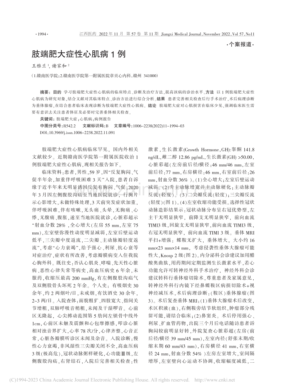 肢端肥大症性心肌病1例_王雅兰.pdf_第1页