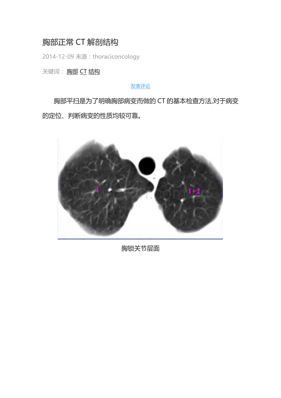 胸部CT正常及病变影像解读.docx_第1页