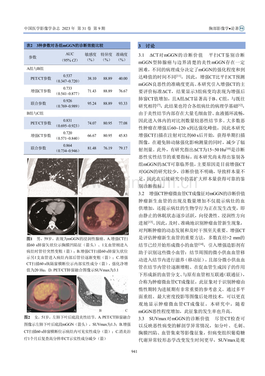 %5E%2818%29F-FDG PET_CT联合增强CT对肺部混合磨玻璃结节的诊断价值.pdf_第3页