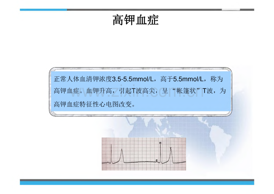 优选电解质紊乱心电图_课件.pdf_第2页