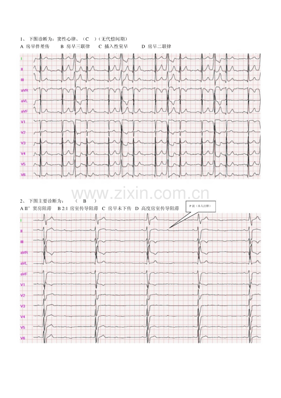 心电图测试题(识图).pdf_第1页