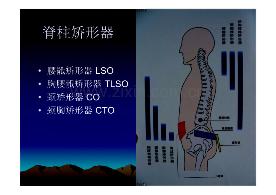 脊柱矫形器 课件.pdf_第1页