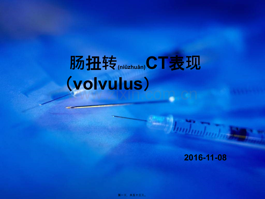 肠扭转总论及CT表现.ppt_第1页