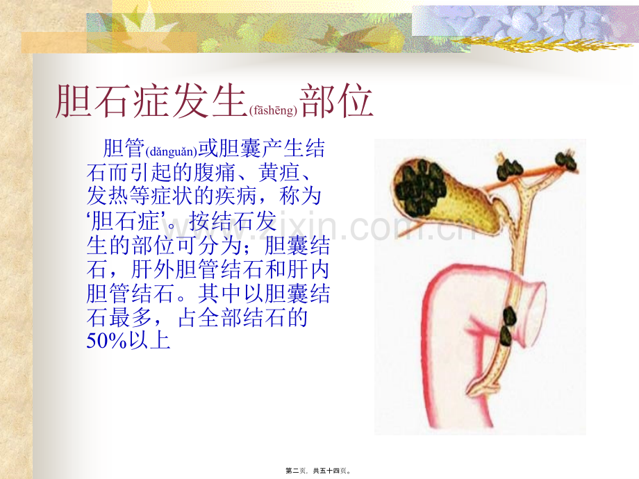 胆石症.ppt_第2页