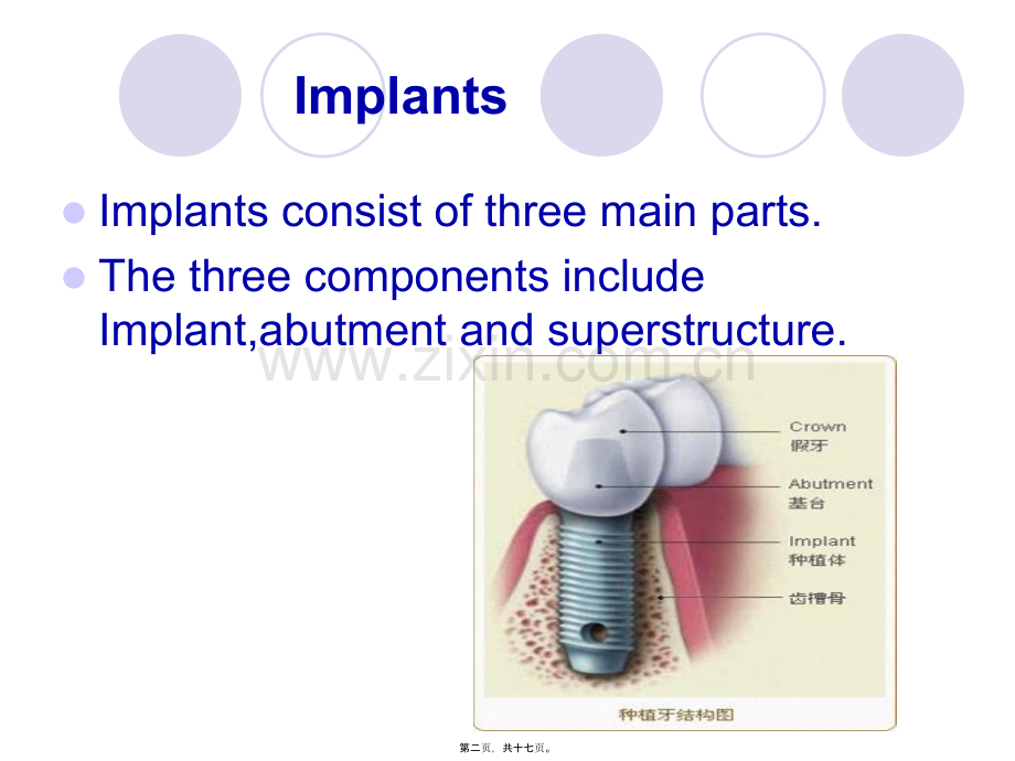 implant-history-and-development-口腔种植.ppt_第2页