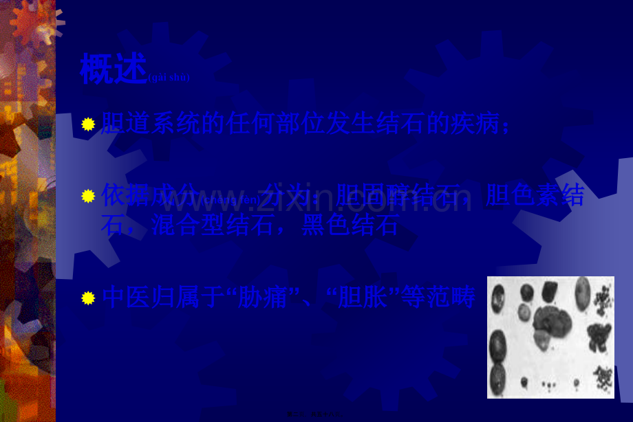胆石症的中西医诊治.ppt_第2页