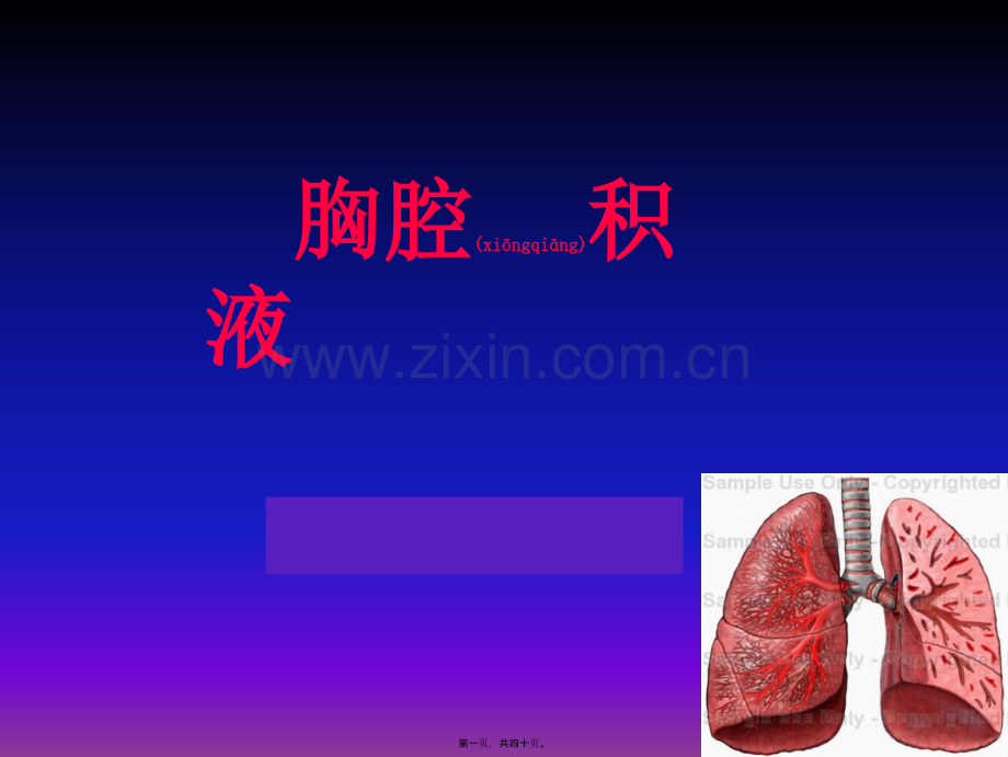 胸腔积液-zjy.ppt_第1页