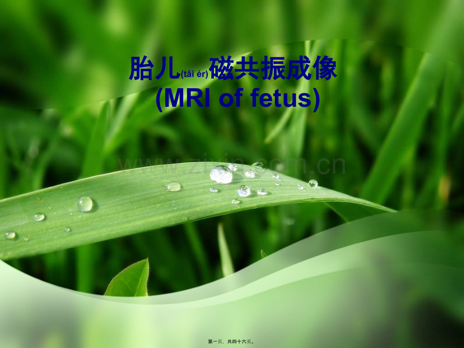 胎儿磁共振成像.ppt_第1页