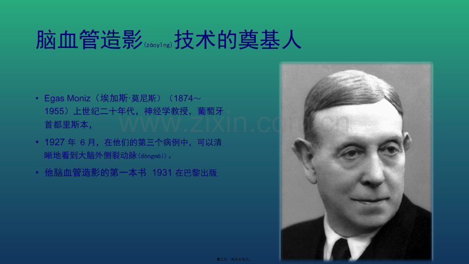 脑血管造影.pptx_第2页