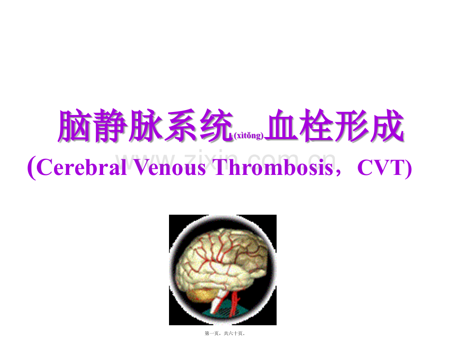 脑静脉系统血栓形成.PPT.ppt_第1页