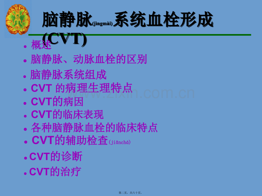 脑静脉系统血栓形成.PPT.ppt_第2页
