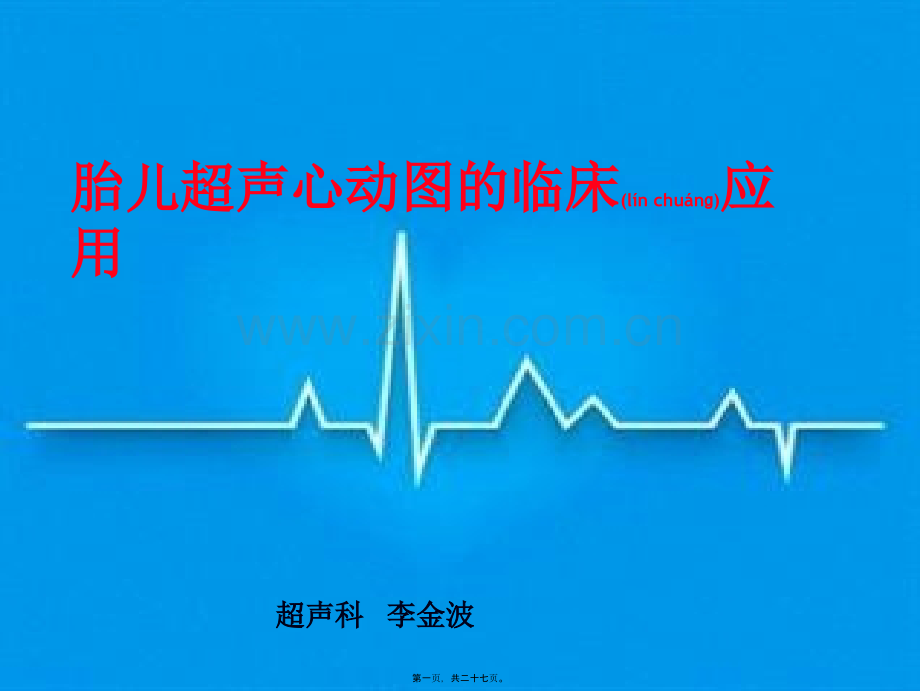 胎儿超声心动图的应用.ppt_第1页