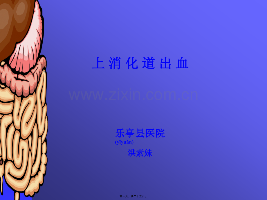 上消化道出血(修改).ppt_第1页