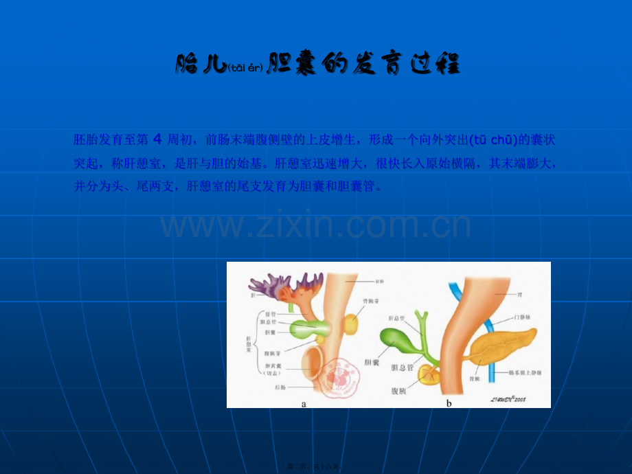 胎儿胆囊超声观察.ppt_第2页