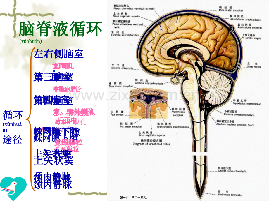 脑积水影像学特征.ppt_第1页
