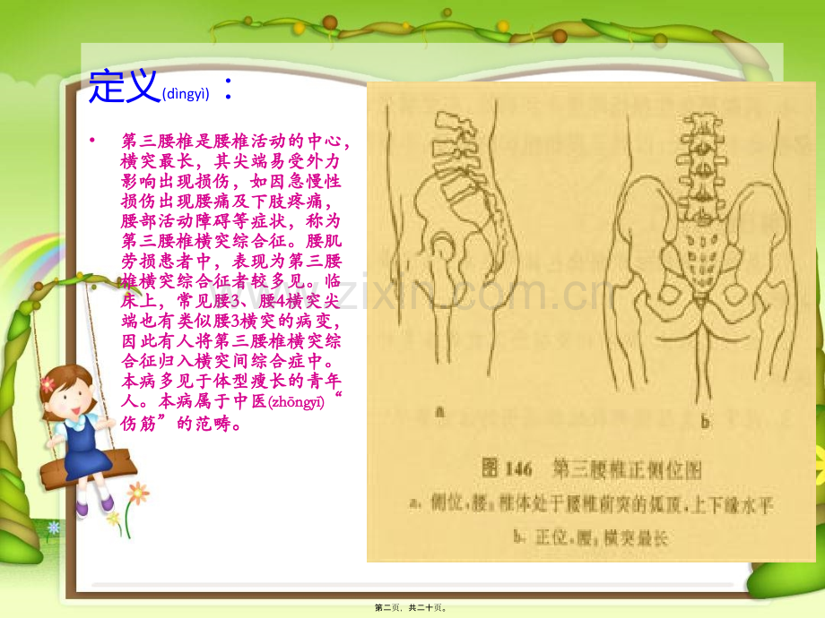 腰3横突综合症1.ppt_第2页