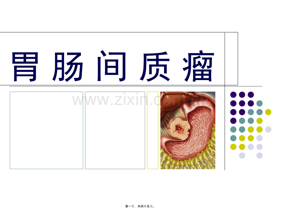 胃肠间质瘤(GIST).ppt_第1页