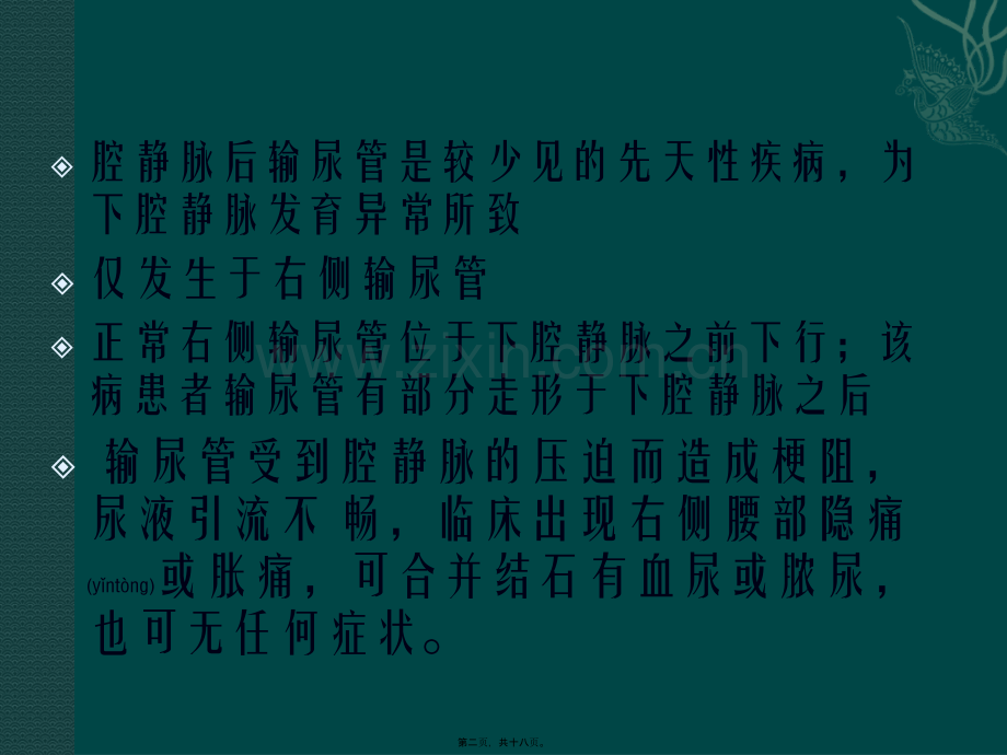 腔静脉后输尿管资料.ppt_第2页