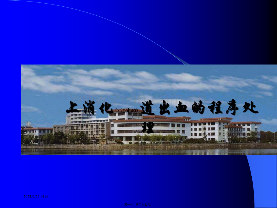 上消化道出血的程序处理.ppt_第1页
