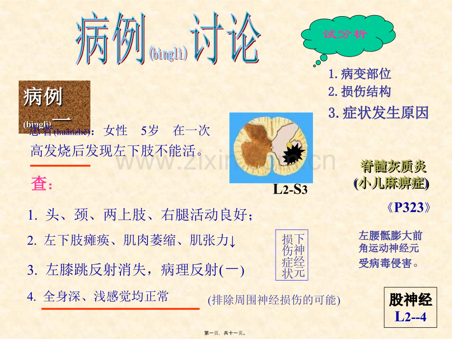 脑神经系统-传导路讨论汇编.ppt_第1页