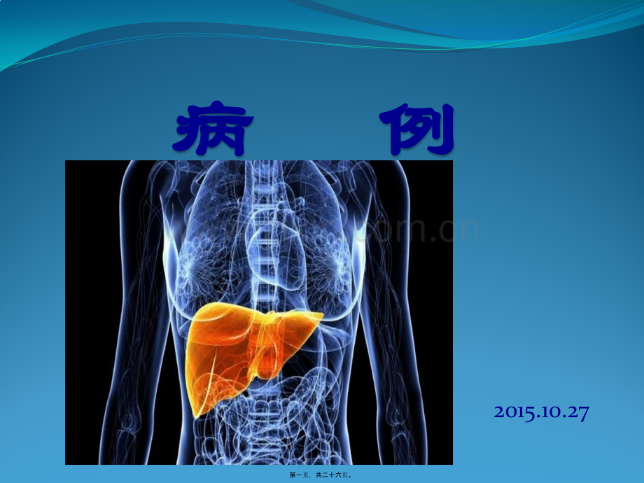 肝包虫病.pptx_第1页