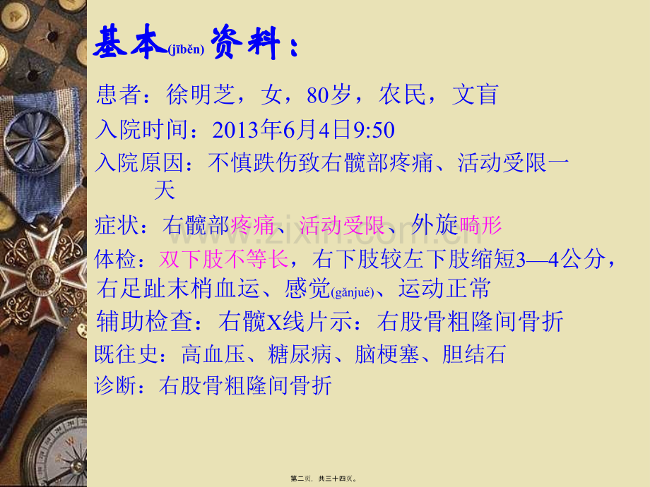 股骨粗隆间骨折新.ppt_第2页