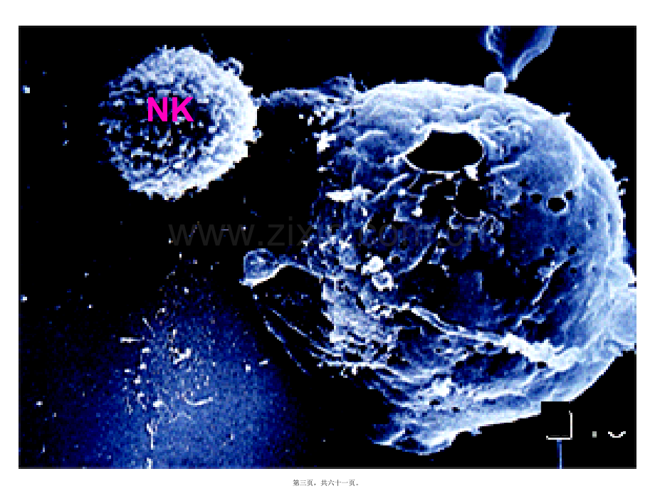学术讨论—NK细胞(2010上).ppt_第3页