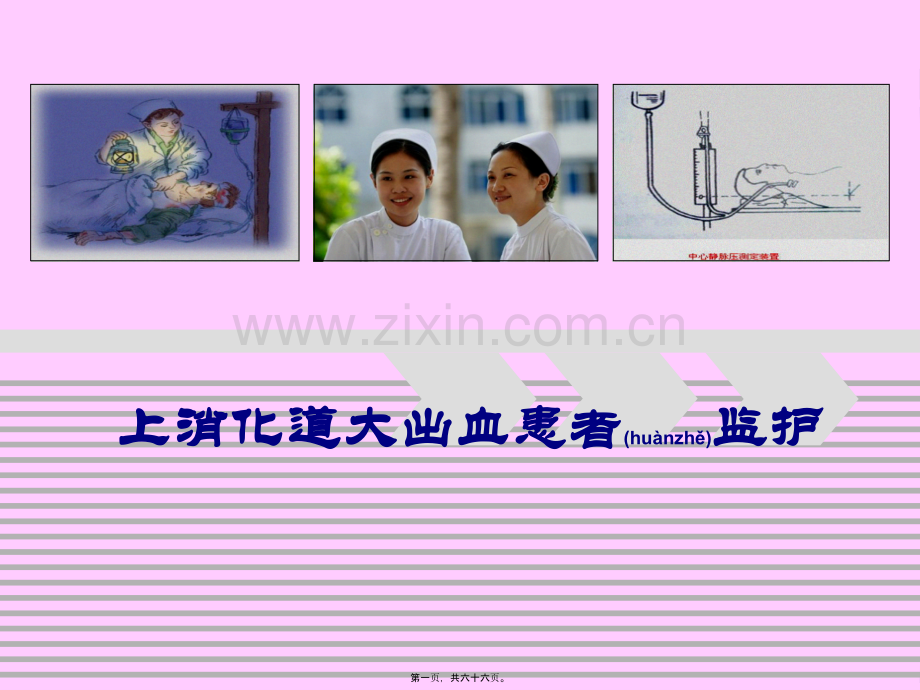 上消化道出血患者监护(2010.11.2).ppt_第1页