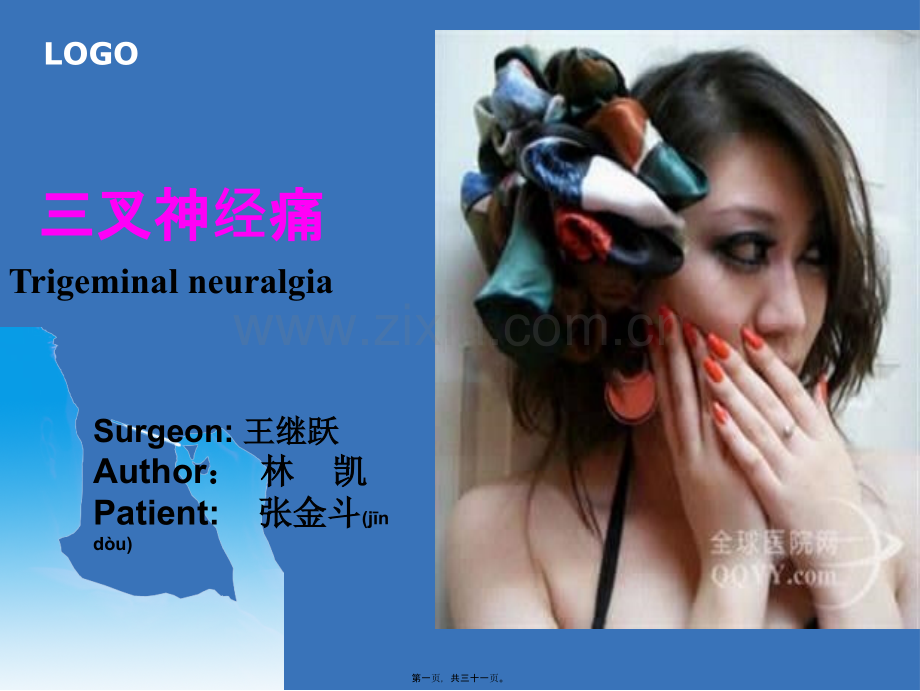 三叉神经痛-.ppt_第1页