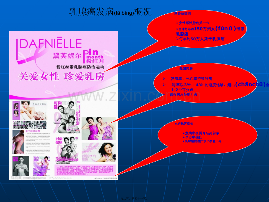 乳腺癌筛查讲座——陈登攀.ppt_第2页