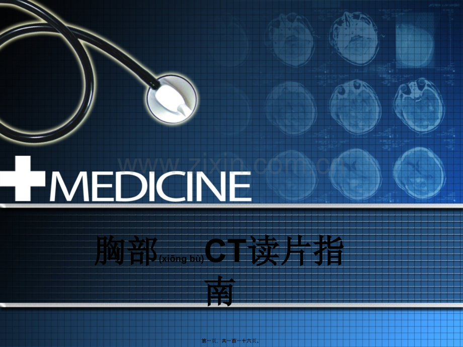 胸部CT读片指南.ppt_第1页