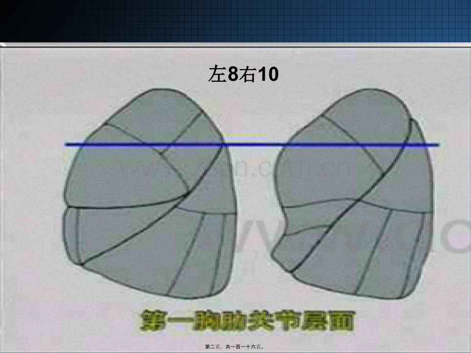 胸部CT读片指南.ppt_第2页