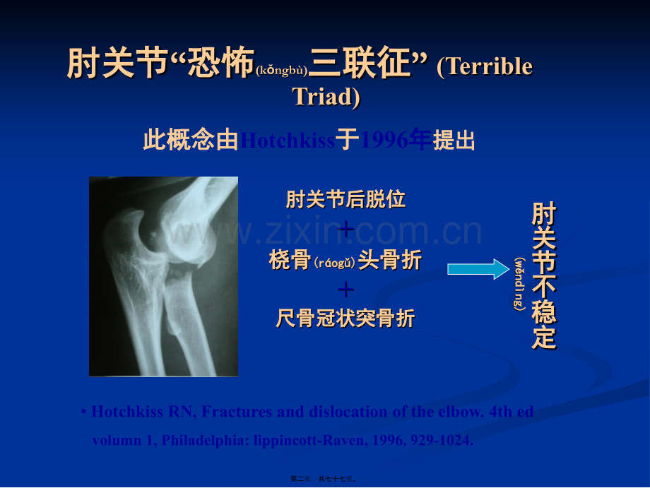 肘关节恐怖三联征的规范化外科治.ppt_第2页