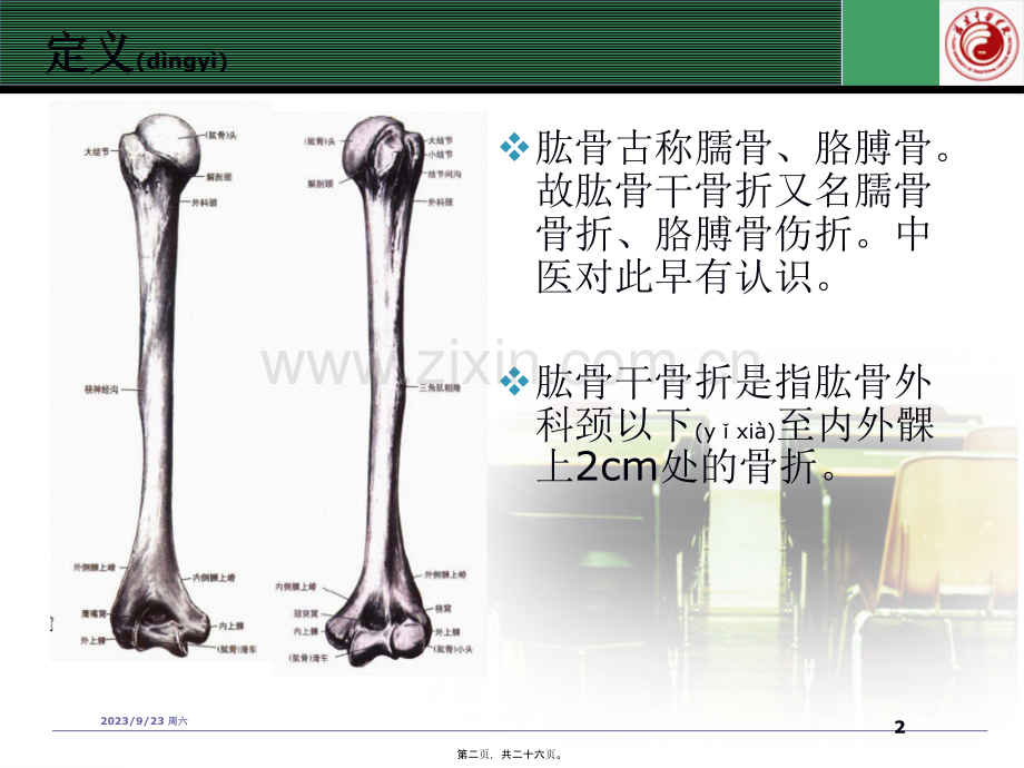 肱骨干骨折..ppt_第2页