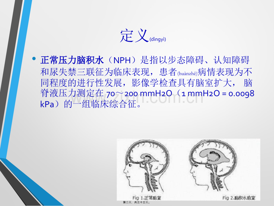 中国特发性正常压力脑积水诊治专家共识(2016).ppt_第2页