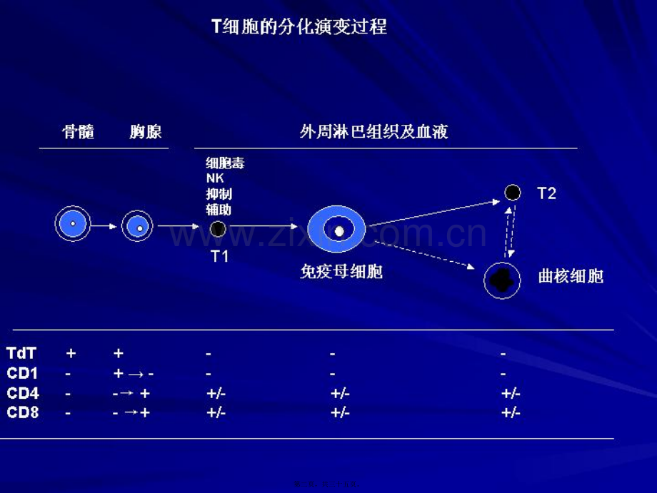 NKT细胞淋巴瘤.ppt_第2页