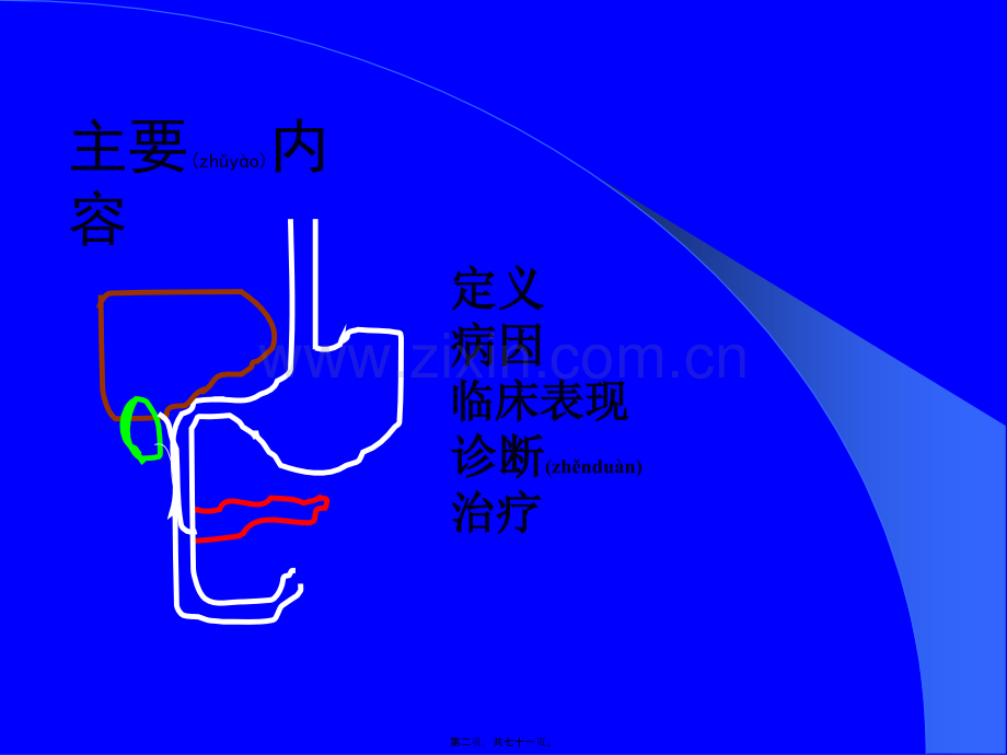 上消化道出血的处理.ppt_第2页