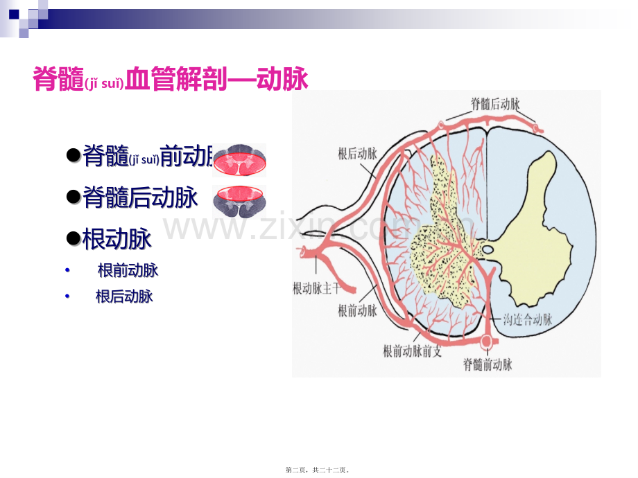 脊髓血管病-周琳.ppt_第2页