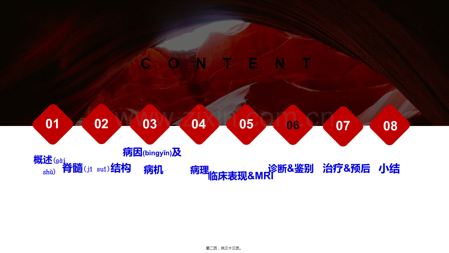 脊髓亚急性联合变性.ppt_第2页