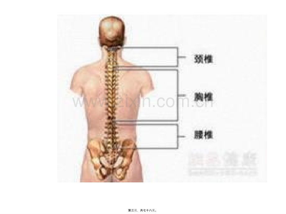 学术讨论—腰椎间盘突出症123(1)介绍.ppt_第3页