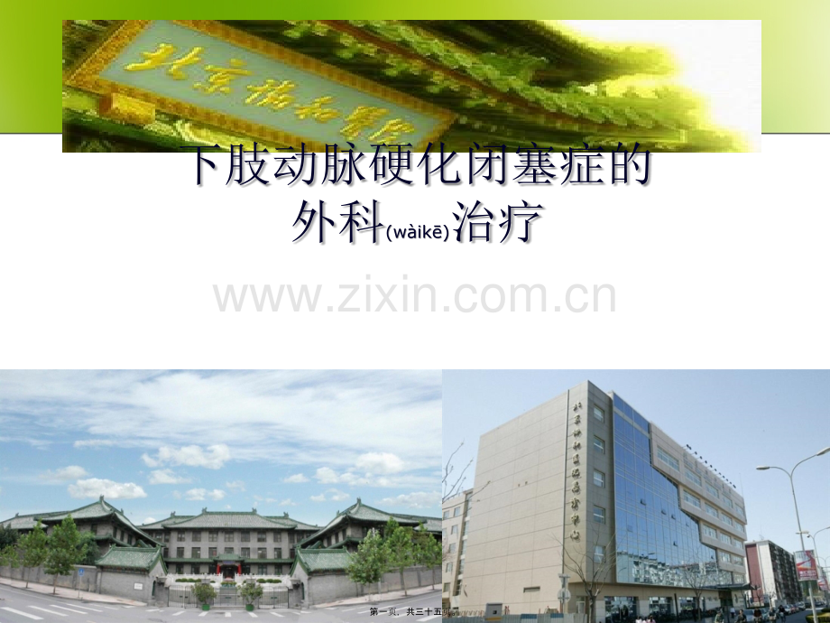 下肢动脉硬化闭塞症分解.ppt_第1页