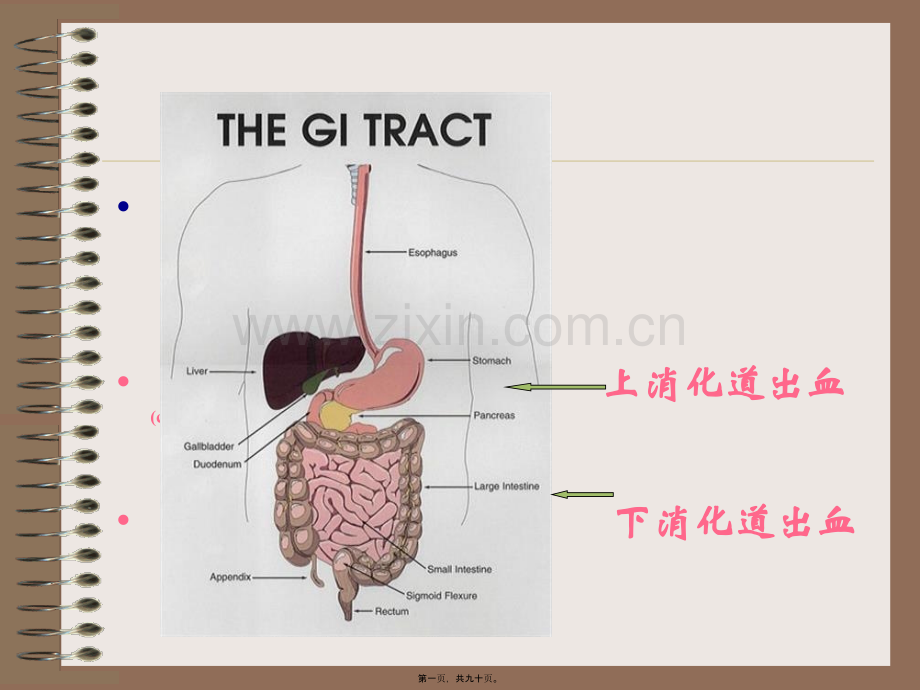上消道大量出血-文档.ppt_第1页