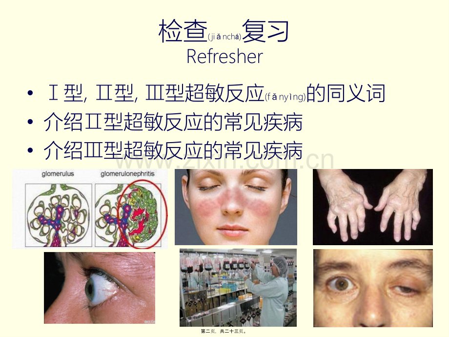 第十讲-T淋巴细胞与细胞因子(上).pptx_第2页