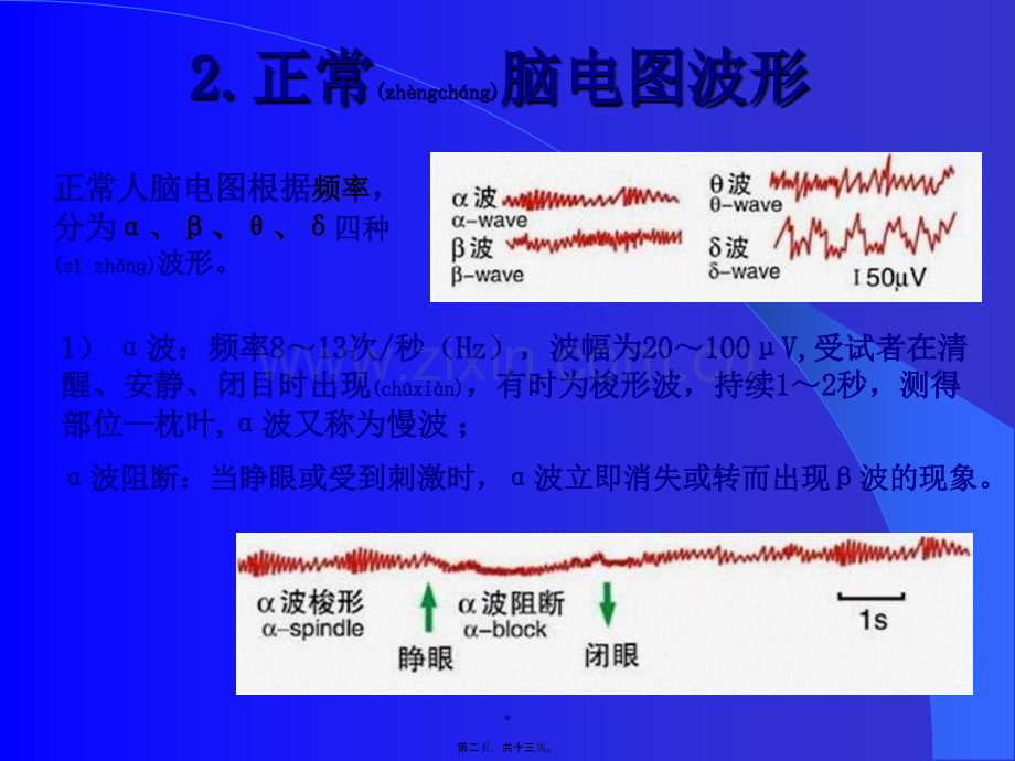 第四节脑的电活动与觉醒.ppt_第2页