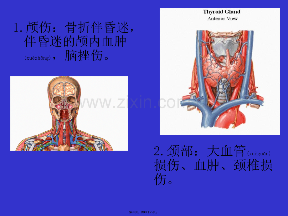 第五讲多发伤急救.ppt_第2页