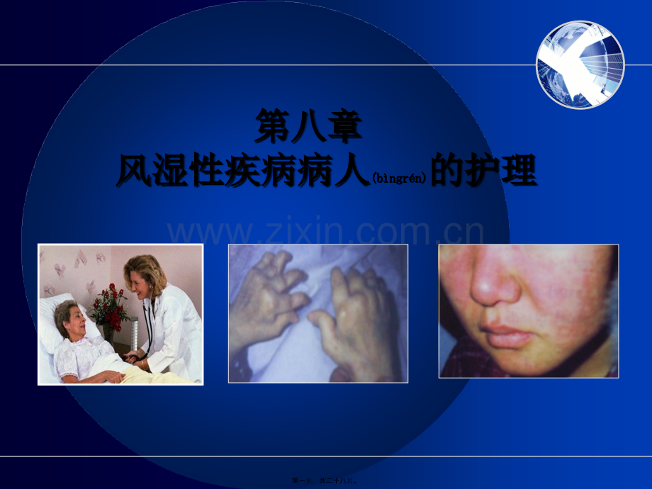 类风湿关节炎-8-2.ppt_第1页