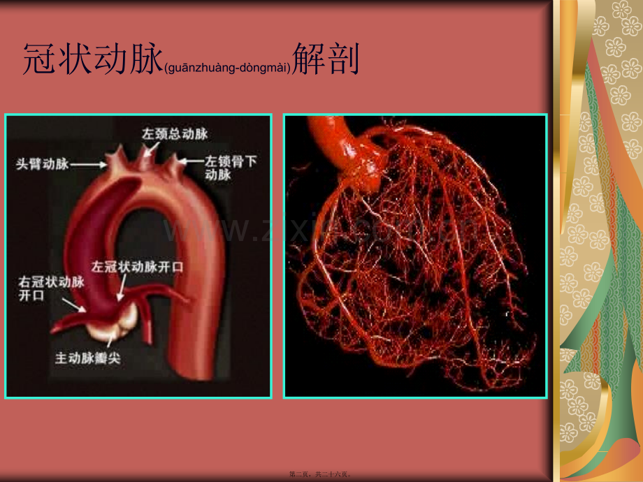 经桡动脉冠脉造影.ppt_第2页