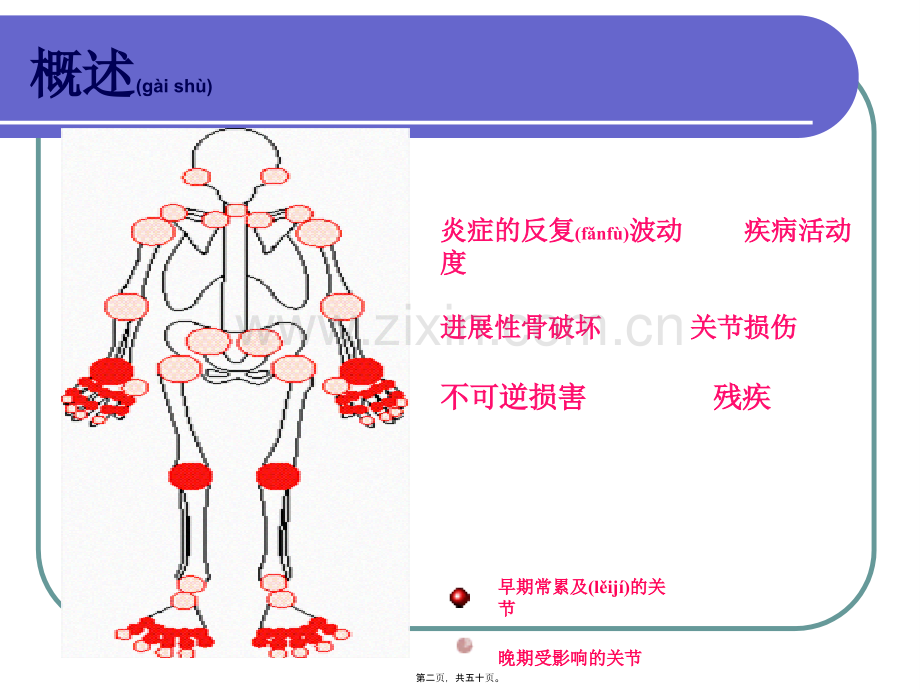 类风湿关节炎.ppt_第2页