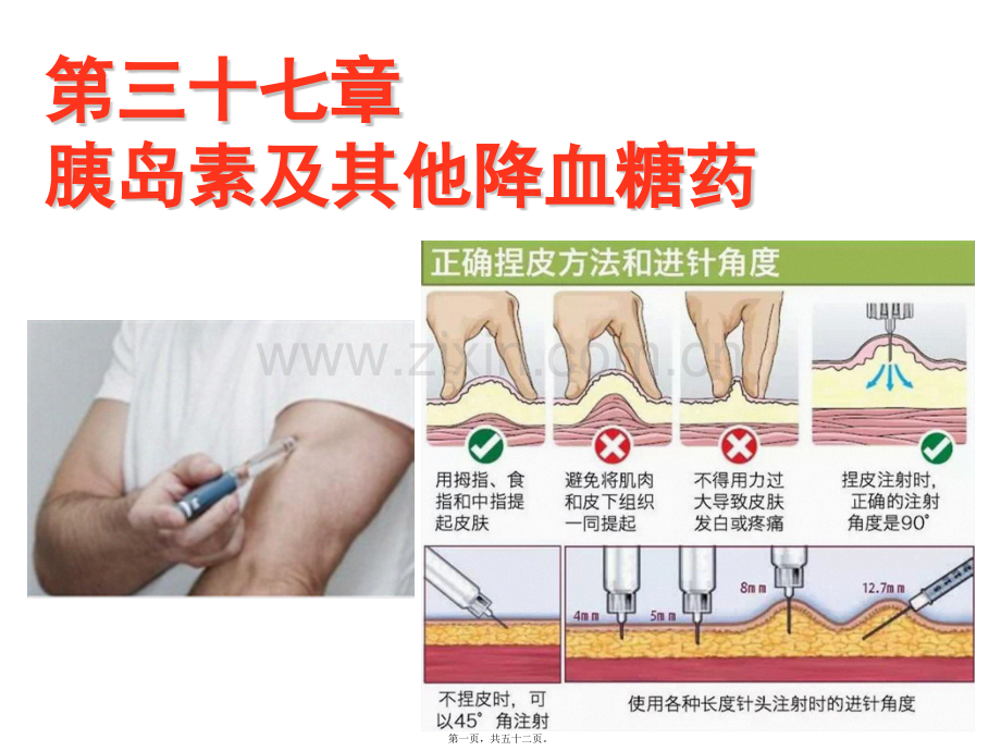 第三十七章-胰岛素与口服降血糖药.pptx_第1页