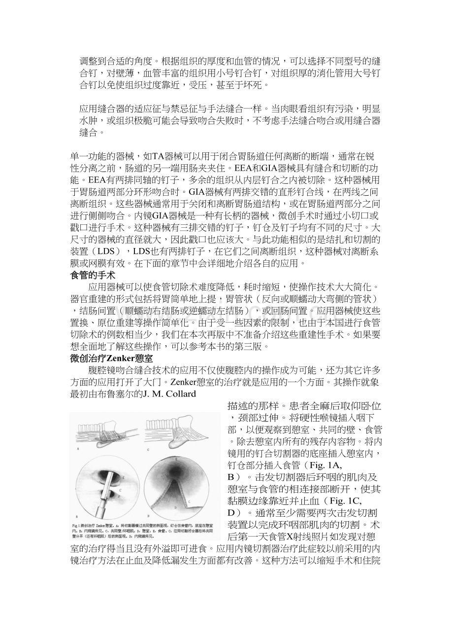 精通外科—普外部分12缝合器技术在胃肠道手术中的应用.docx_第2页